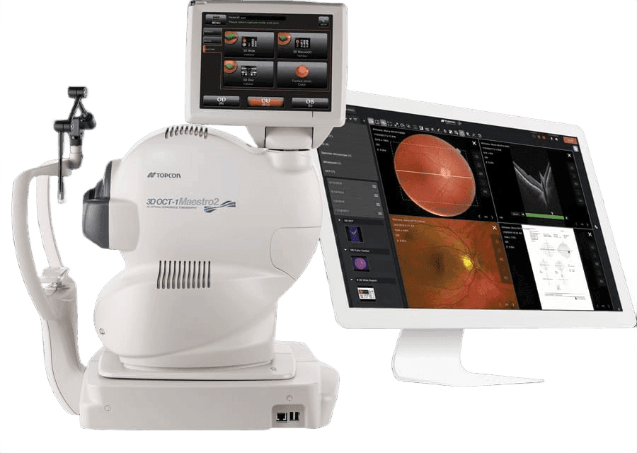 OCT & OCTA at KVM Eye Hospital, Gwalior